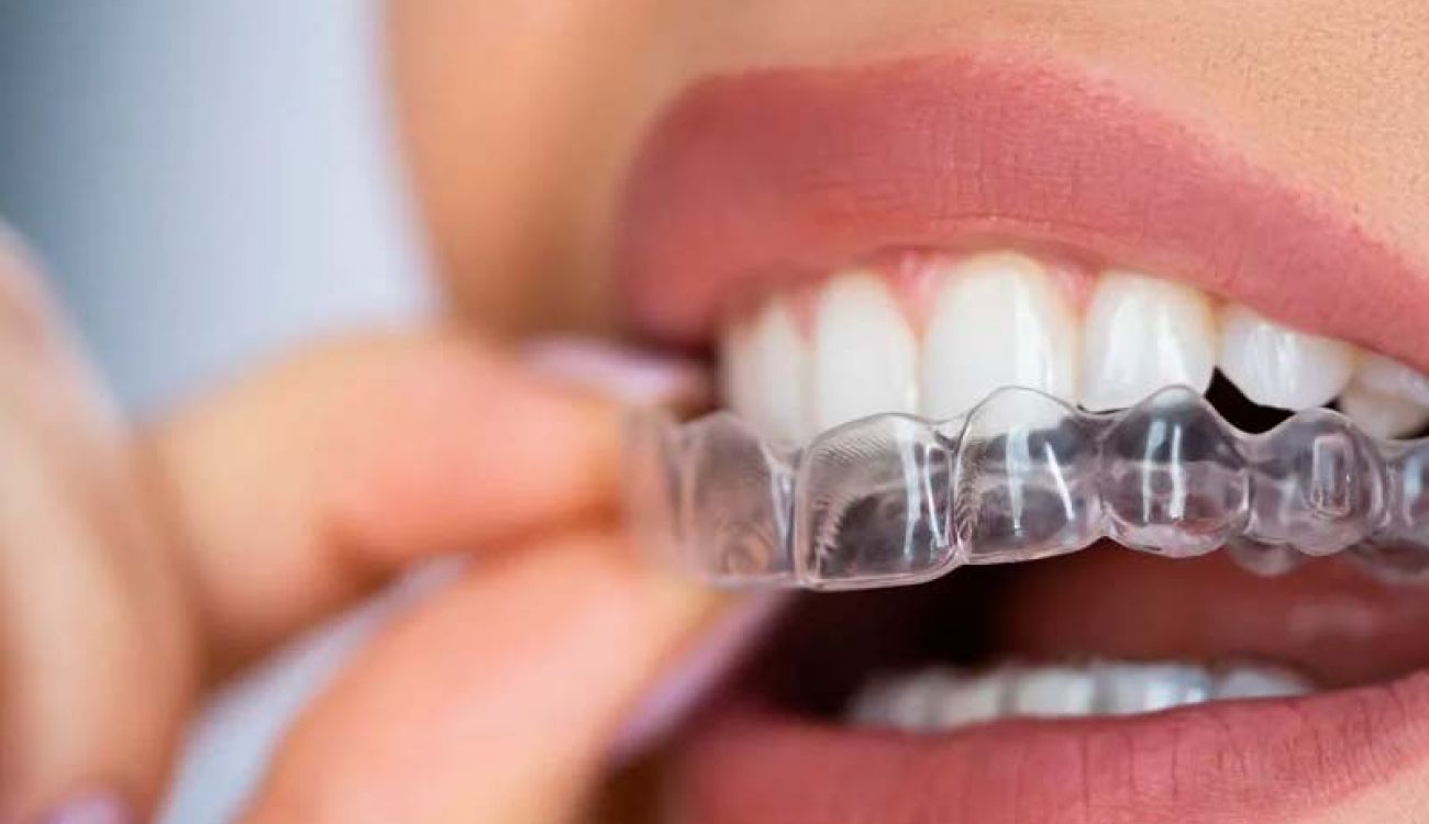 dentista estetico gijon