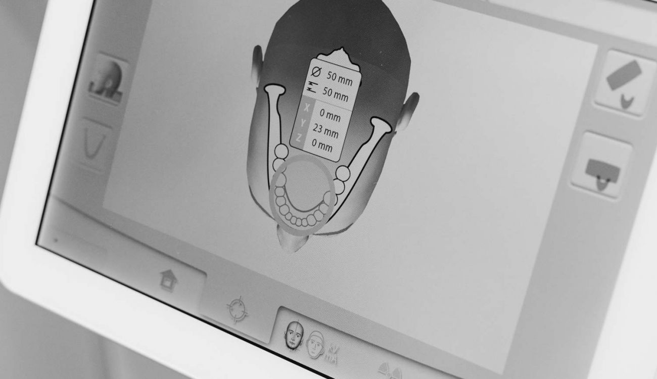 dentista estetico gijon