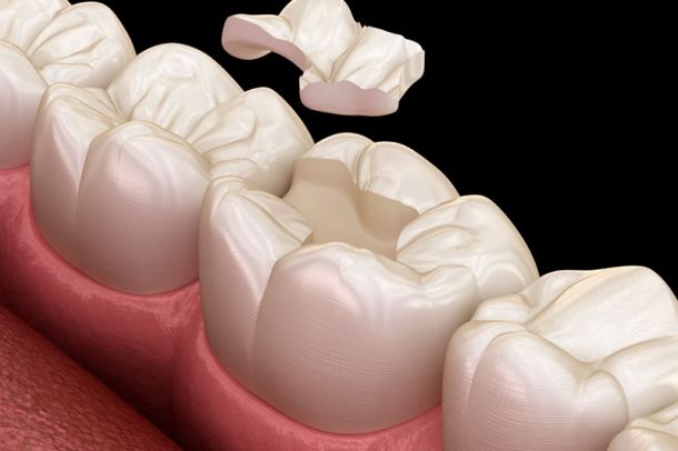 Odontología Restauradora