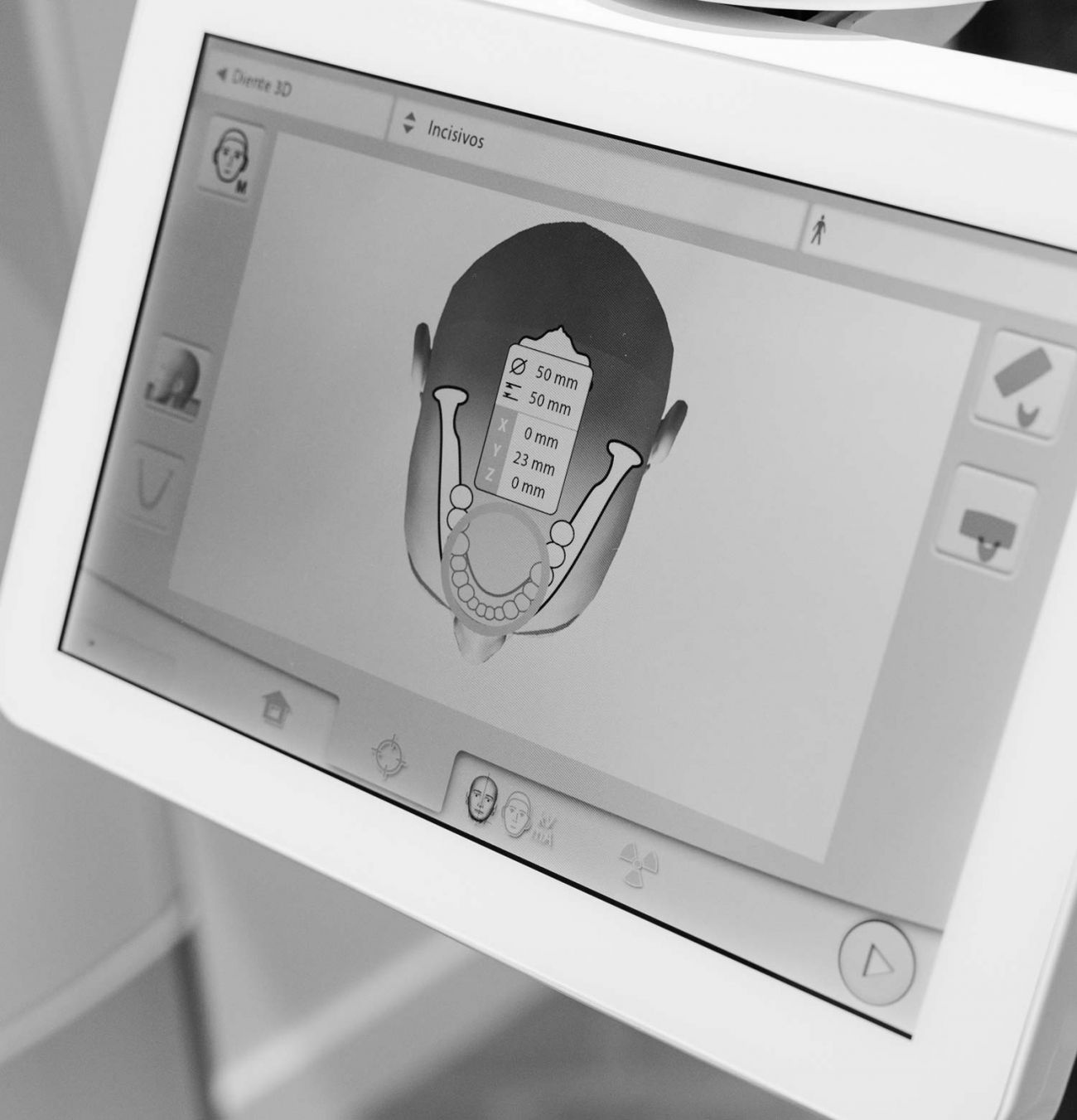 ferulas dentales gijon