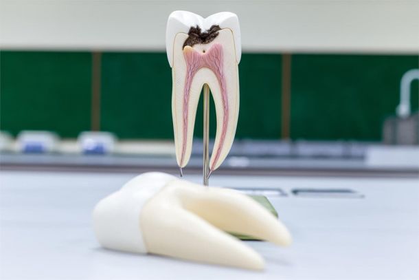 Endodoncia
