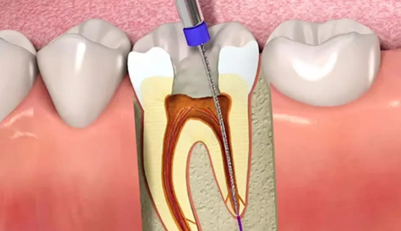 dentista urgencia Gijón